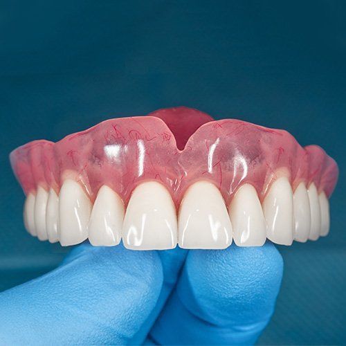 Natural-looking dentures that blend with facial features